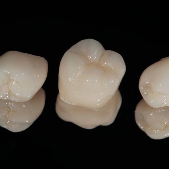 Dental crowns